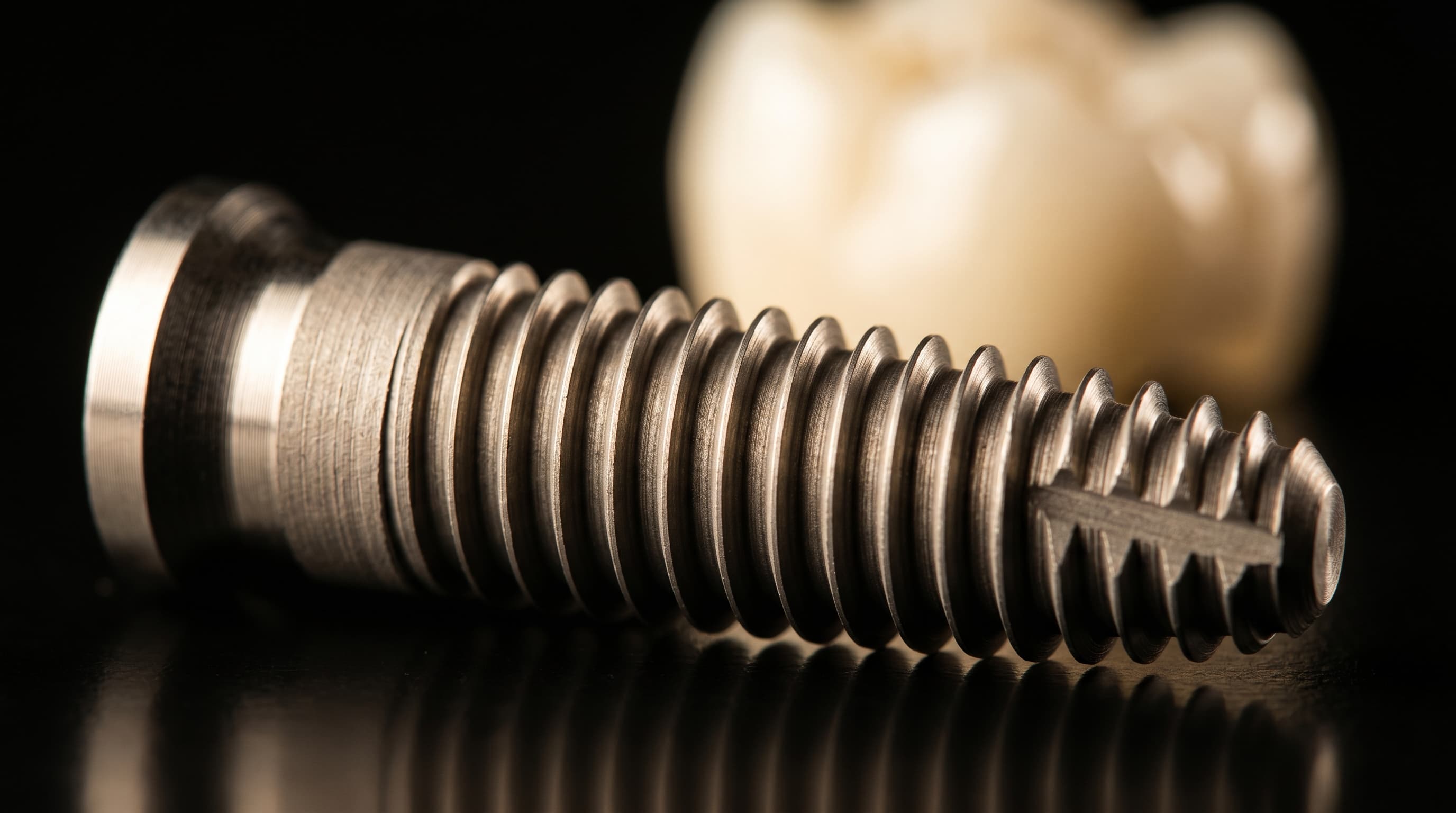 Dental Implant Cost in Wylie, TX: 2026 Full Breakdown