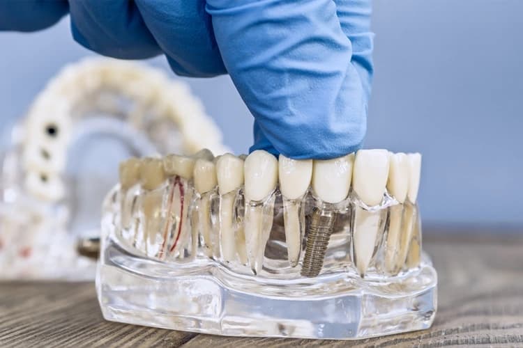 Emergency Dental Care